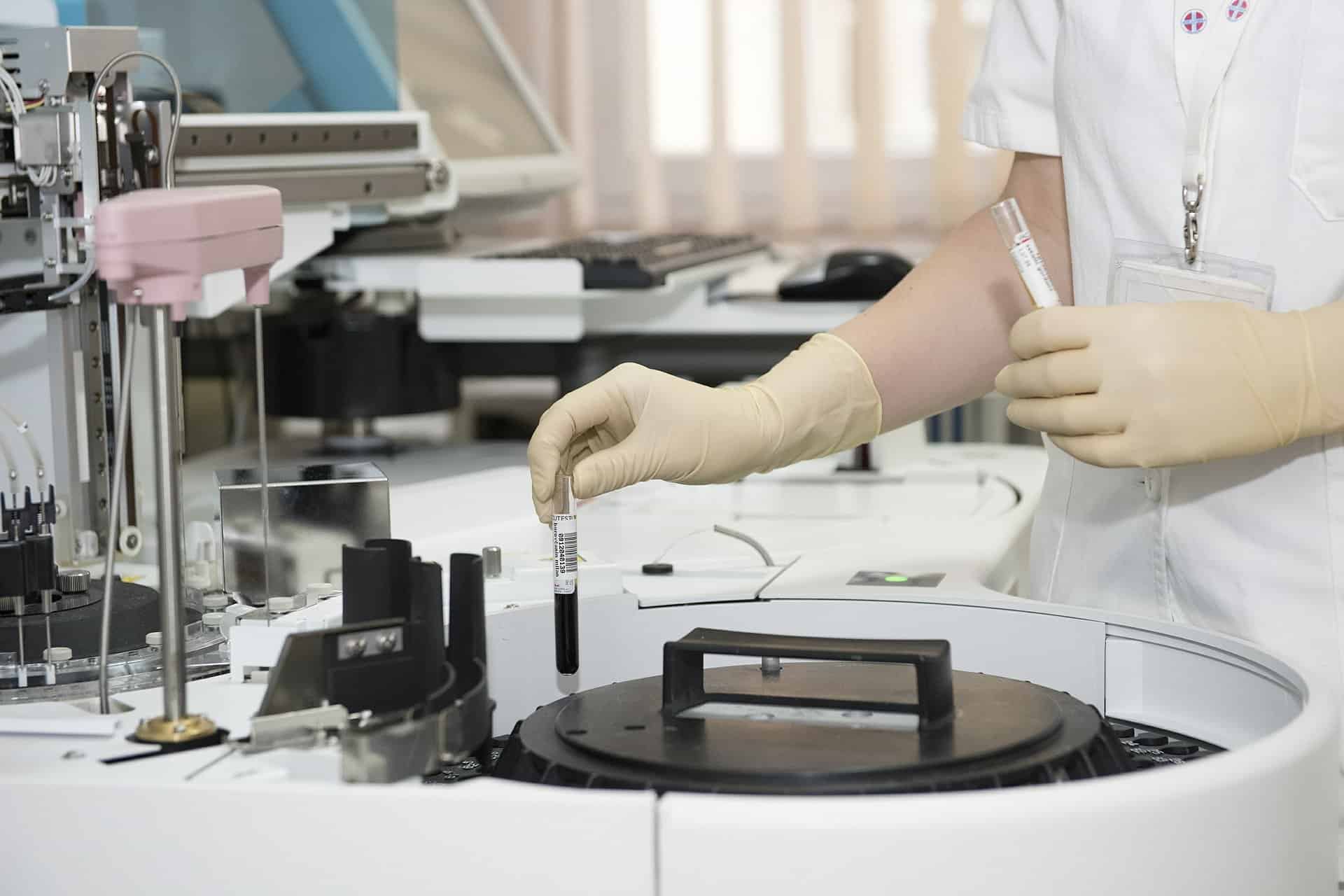 237 nuevos casos de coronavirus elevan el total a 668 en Castilla y León