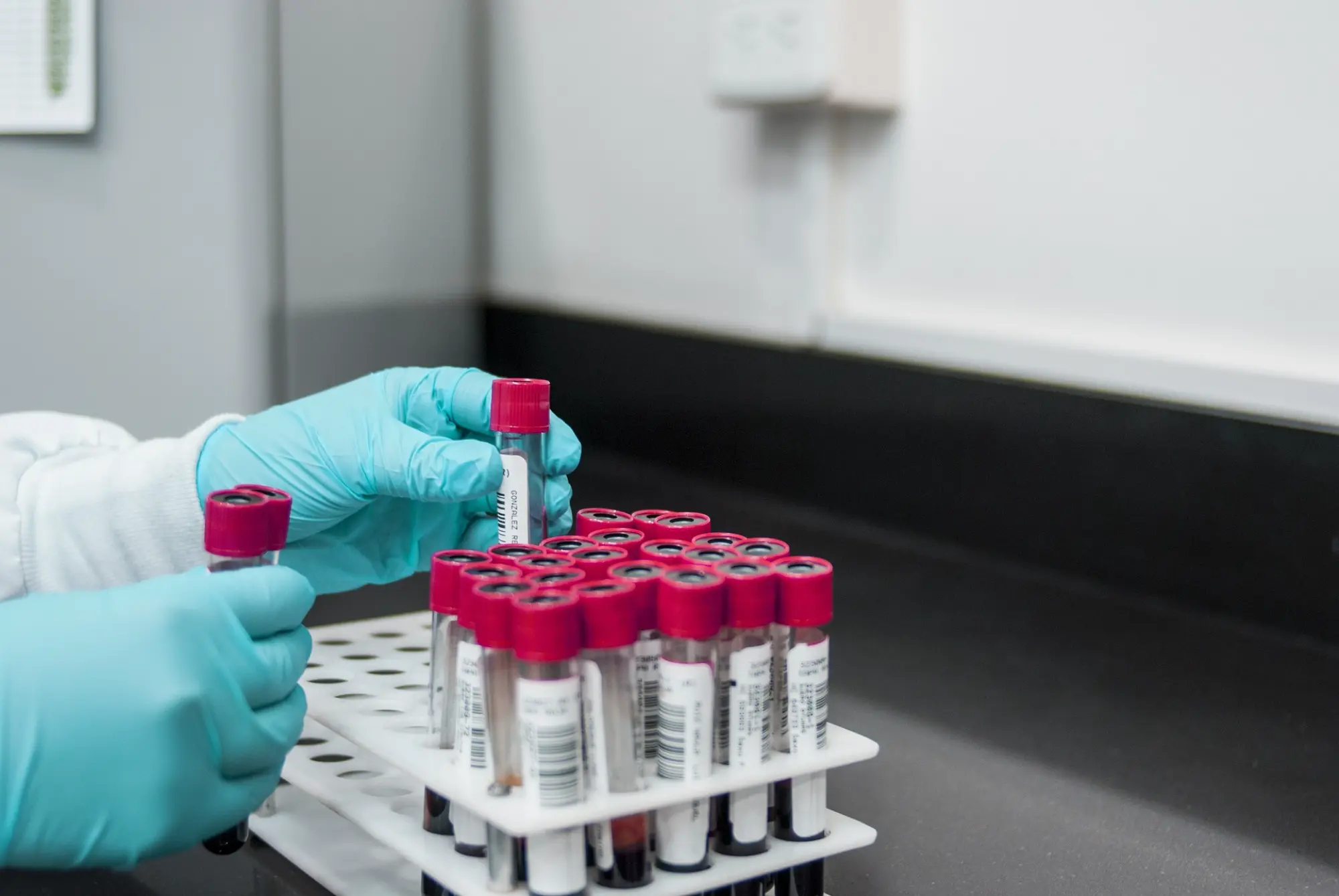 Palencia mantiene la estabilidad en donaciones de sangre y plasma en 2024